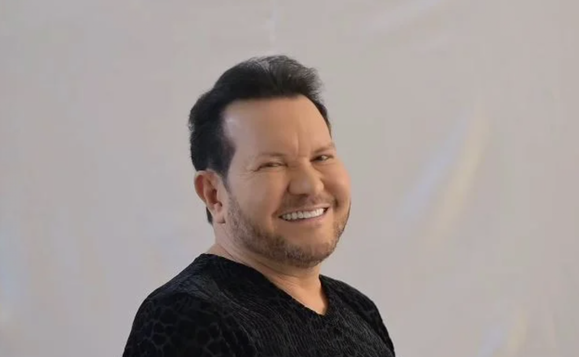 Ximbinha compartilha antes e depois, após procedimento estético - reprodução Instagram