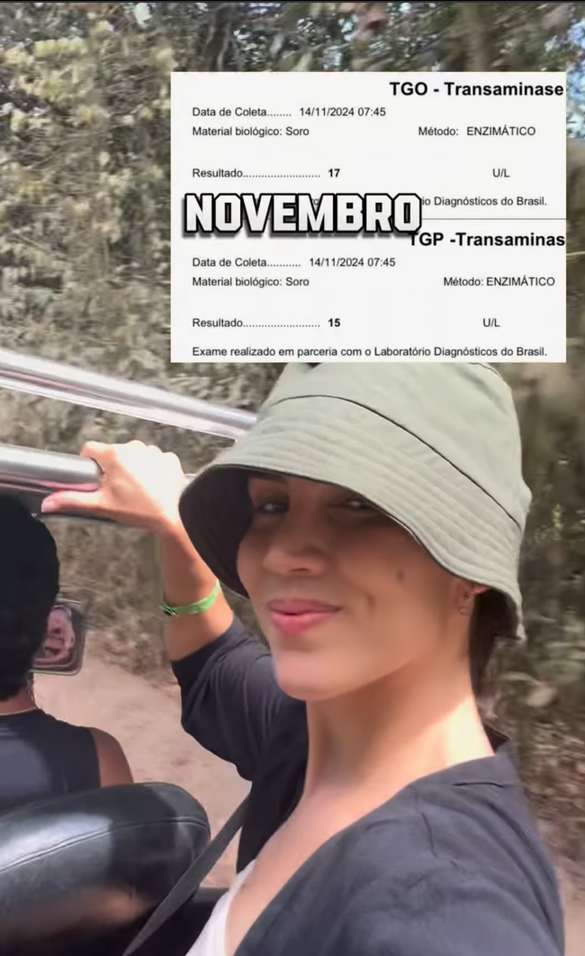 Pérola Faria revela diagnóstico de hepatite autoimune - reprodução Instagram