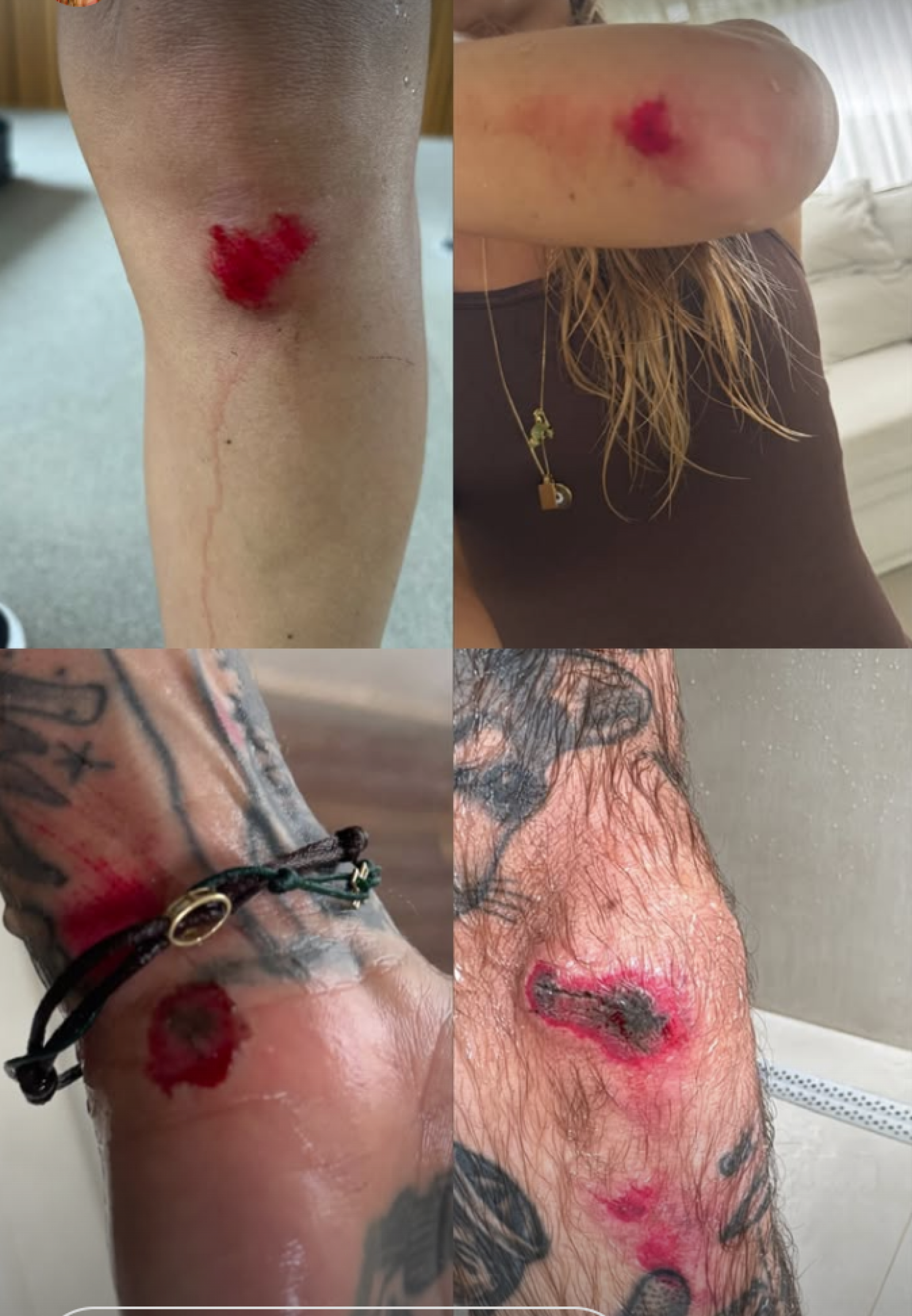 Shantal e Mateus Verdelho sofrem acidente de bicicleta - reprodução Instagram