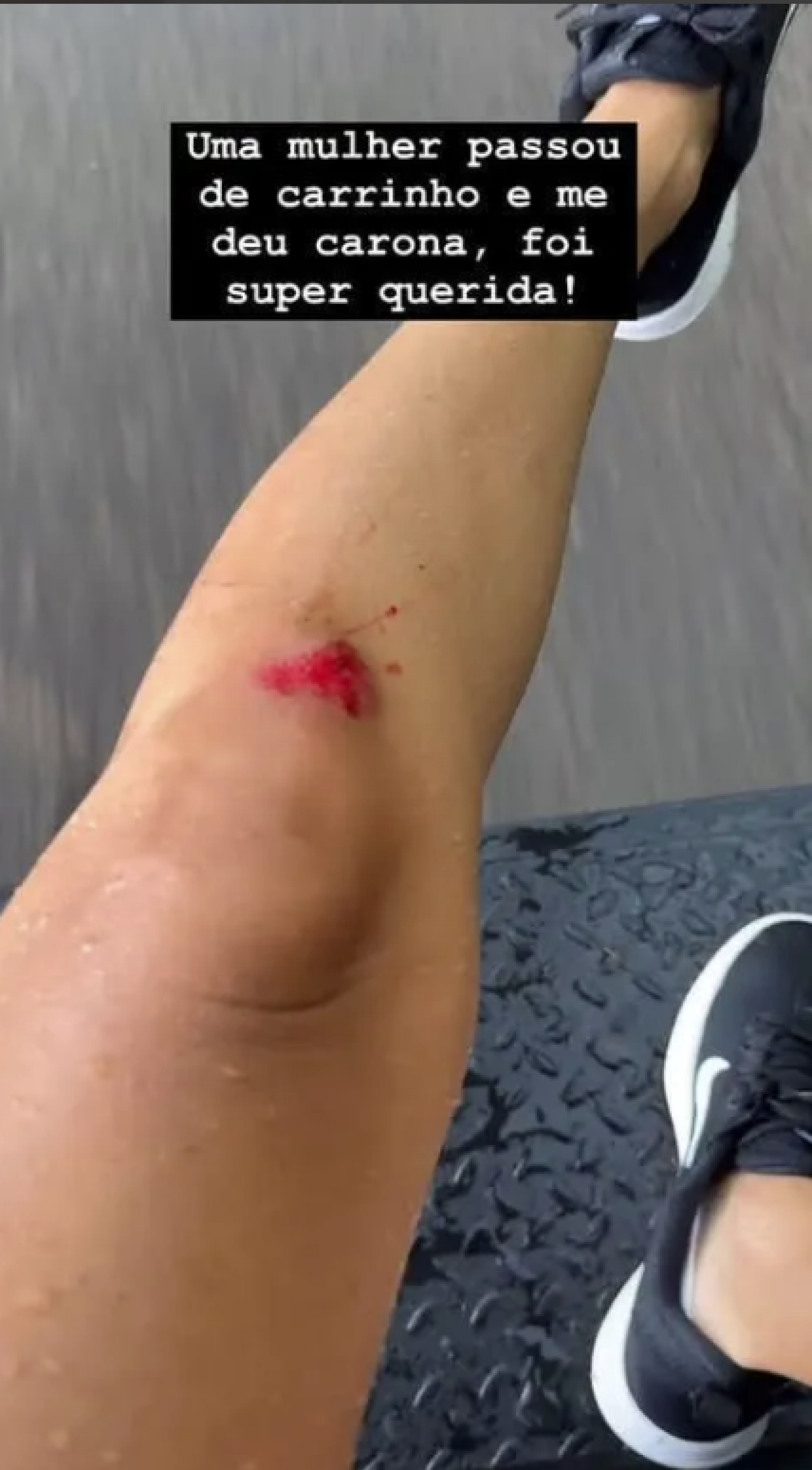 Shantal e Mateus Verdelho sofrem acidente de bicicleta - reprodução Instagram