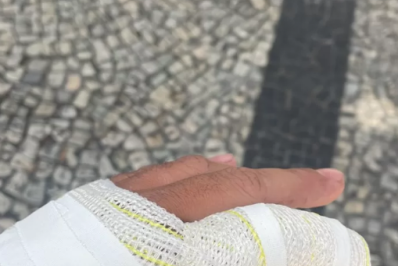 Turista afirma que foi agredido em quiosque de Cabo Frio por não querer pagar taxa de 10%