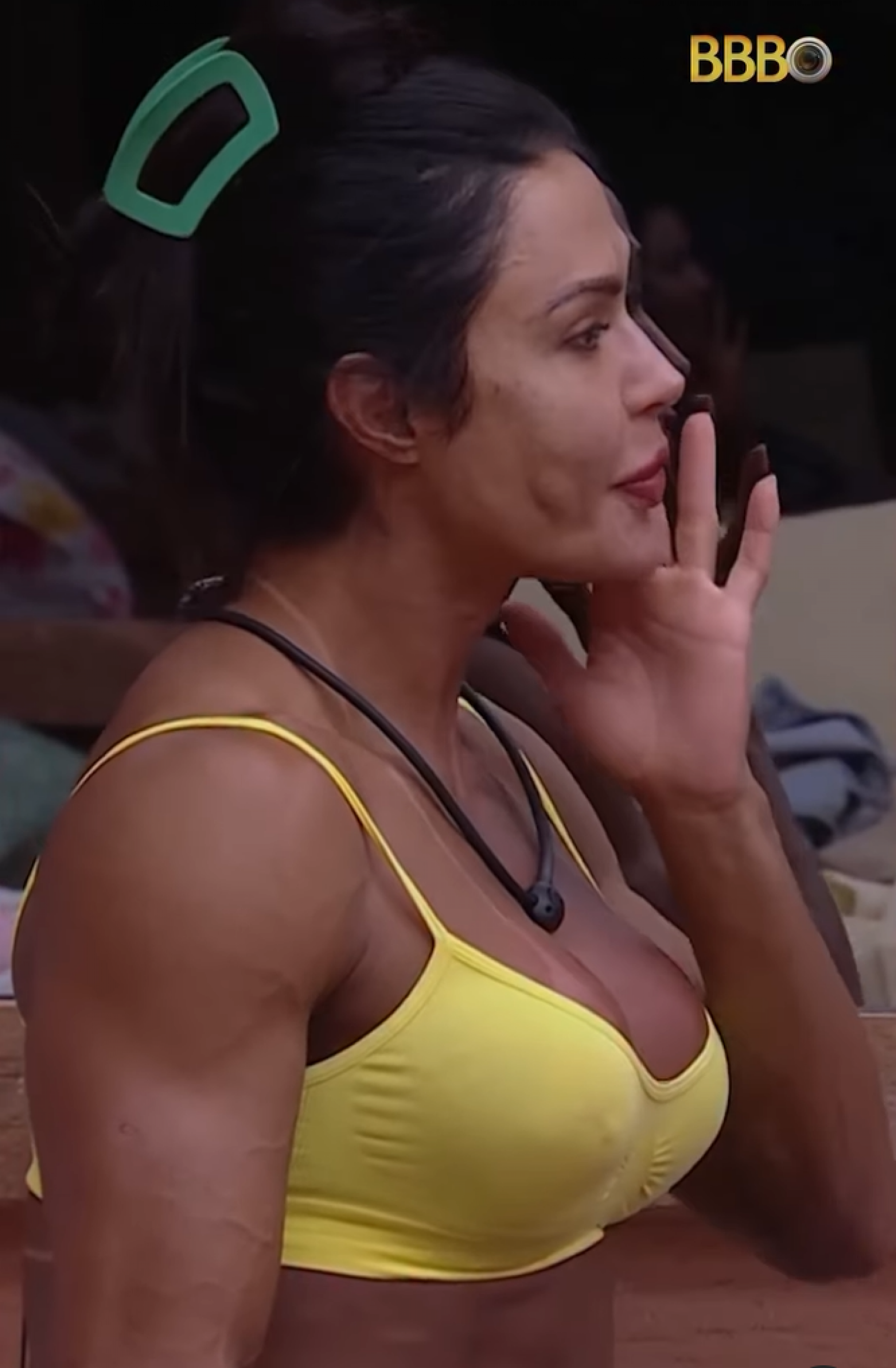 Gracyanne Barbosa viraliza com deformação no rosto - TV Globo