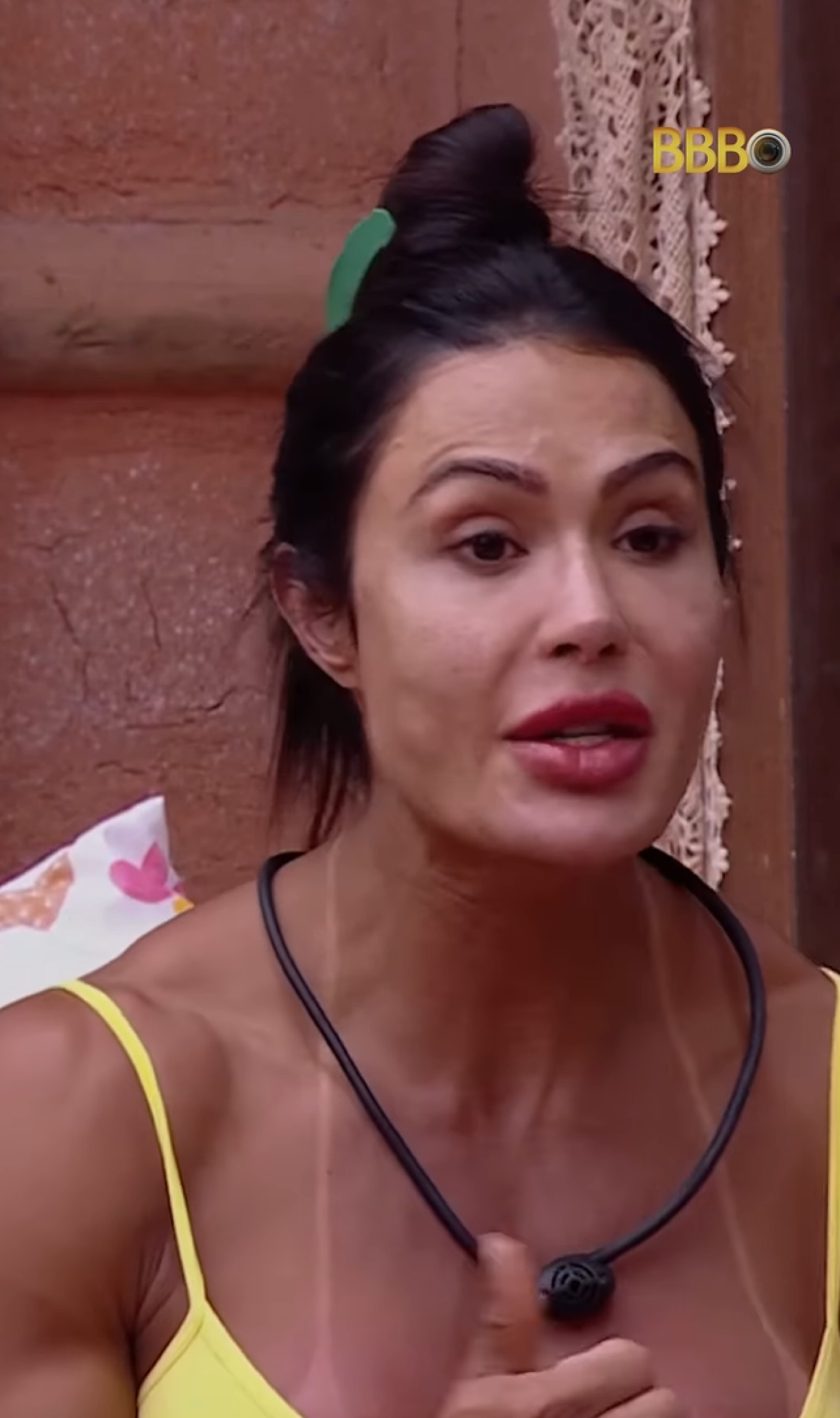 Gracyanne Barbosa viraliza com deformação no rosto - TV Globo