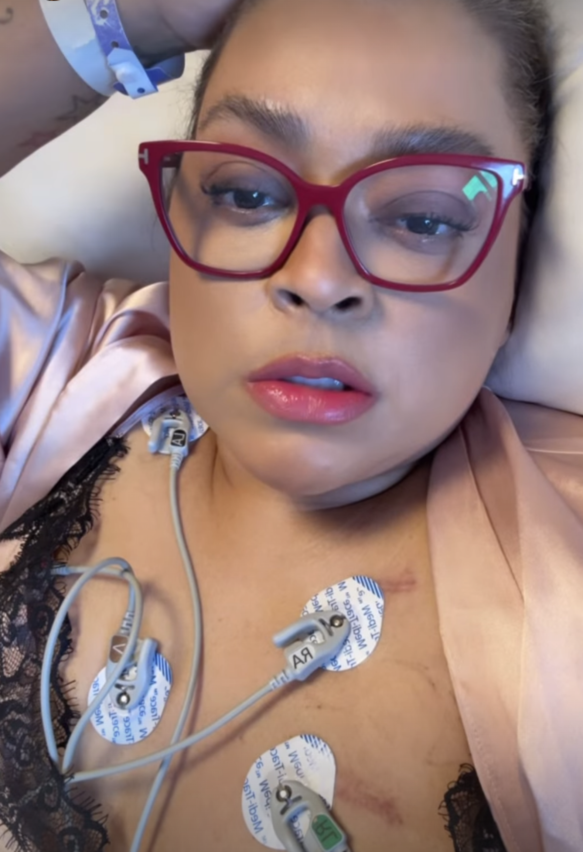 Preta Gil relata que passou por um novo procedimento - Reprodução Instagram