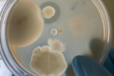 Bactérias da Amazônia podem desenvolver novos medicamentos contra infecções e tumores