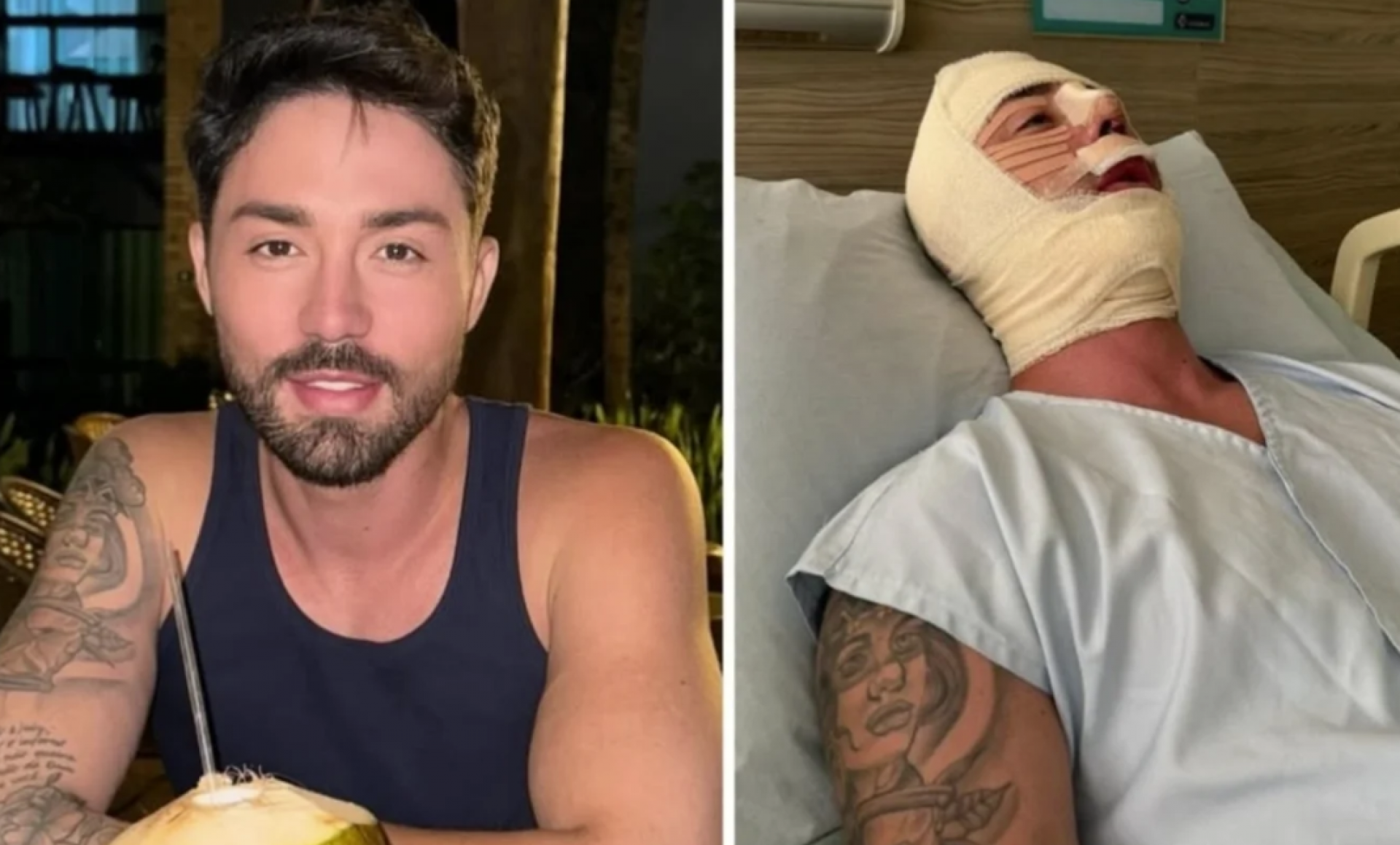 Rico Melquiades passa por 11ª cirurgia facial - reprodução Instagram