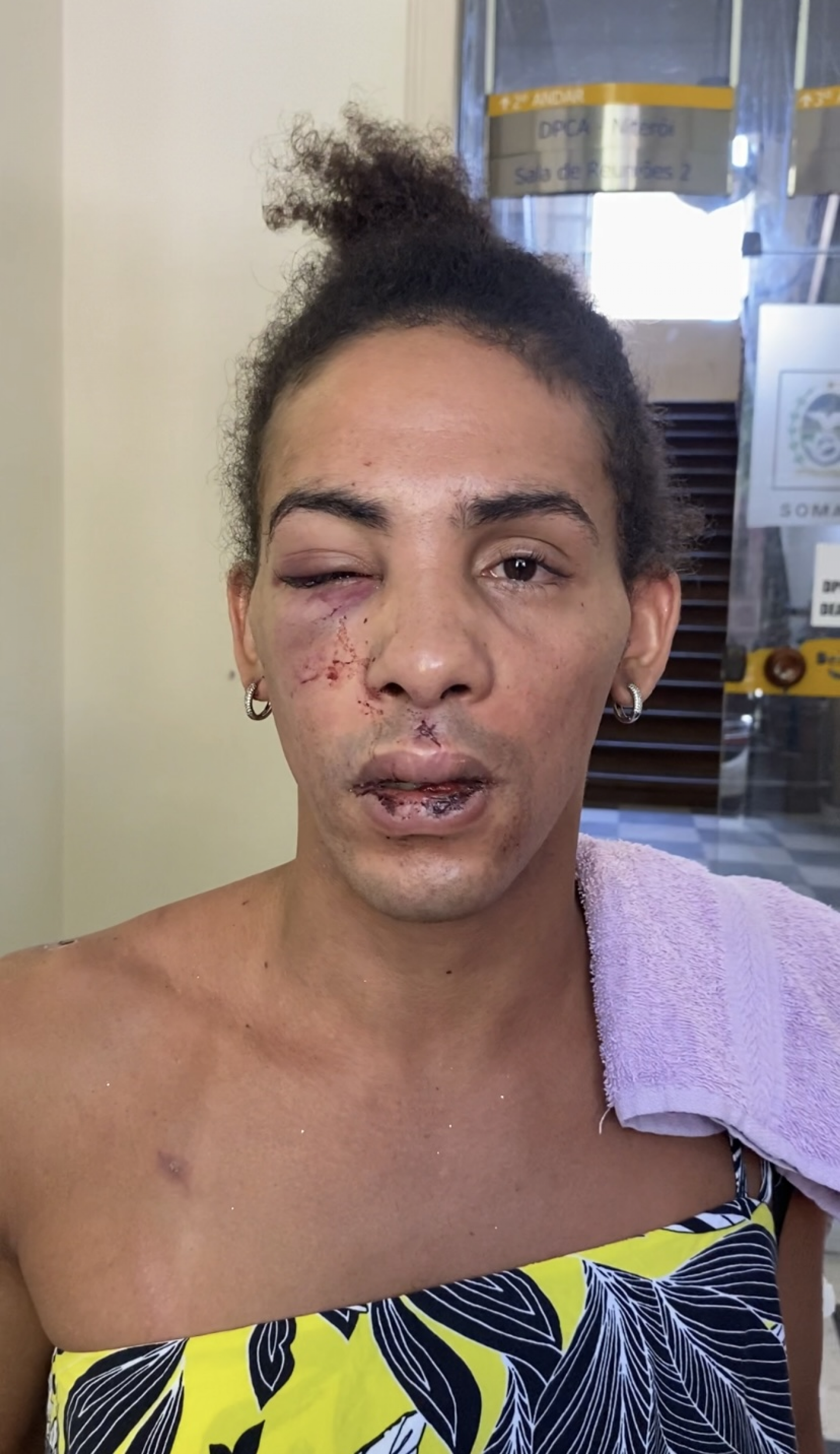 Nathalia Costa foi agredida em frente ao Terminal Rodoviário João Goulart, em Niterói