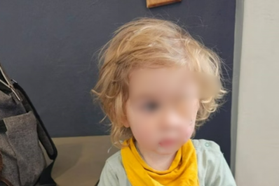 Menino de 2 anos perde a visão de um olho depois de ser beijado por pessoa com herpes labial