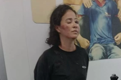 Acusada de tentativa de homicídio contra lutador em Cabo Frio tem rosto desfigurado