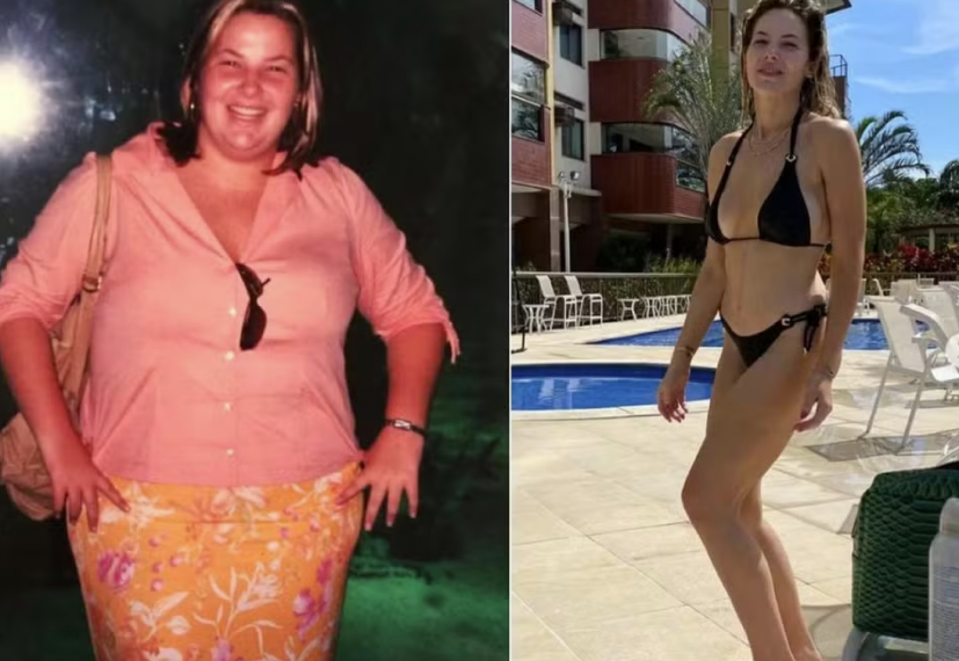 Antes de depois de Luiza Zveiter  - reprodução Instagram