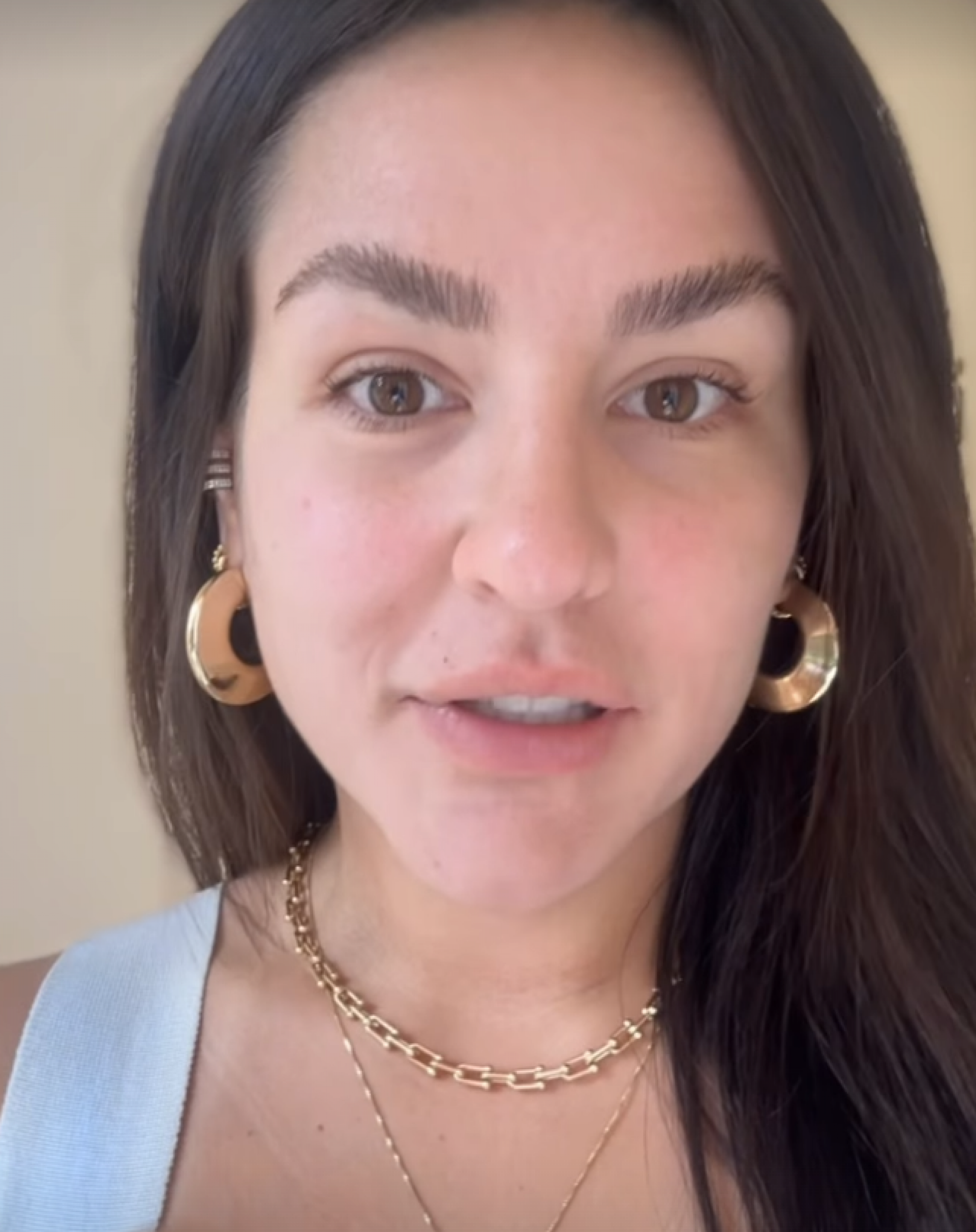 Kéfera busca aparência mais natural após remover preenchimentos e botox - reprodução Instagram