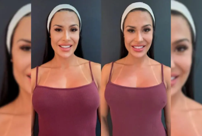 Nipple filler em alta: confira procedimento íntimo feito por Gracyanne