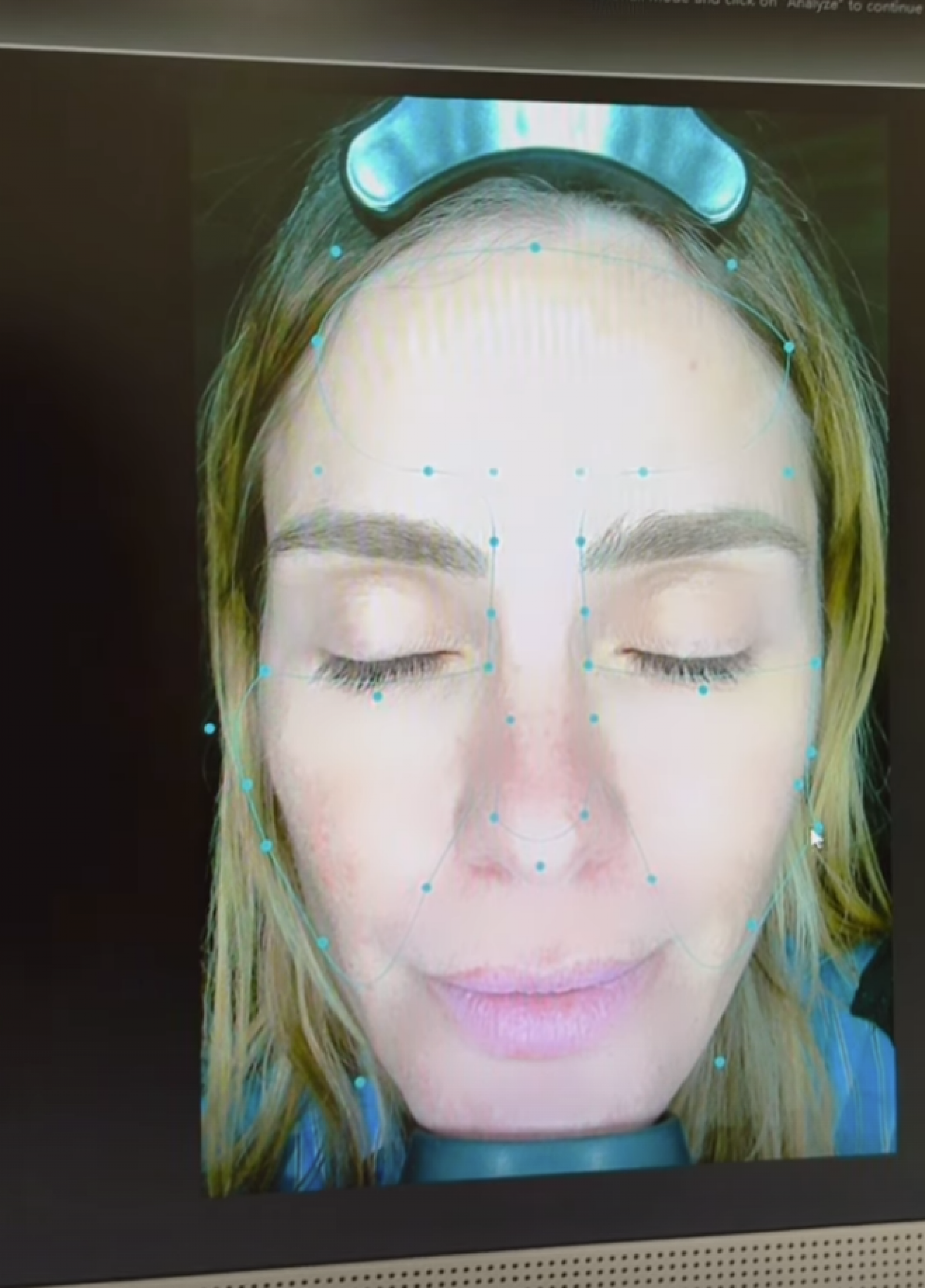 Carolina Dieckmann descobre idade da pele durante avaliação estética  - reprodução Instagram