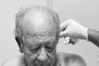 Idoso é atacado por dois pit bulls em Araruama e perde parte da orelha