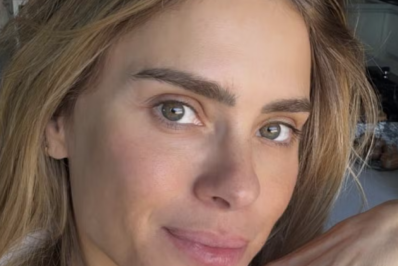 Carolina Dieckmann exibe pele sem filtro após dica de skincare