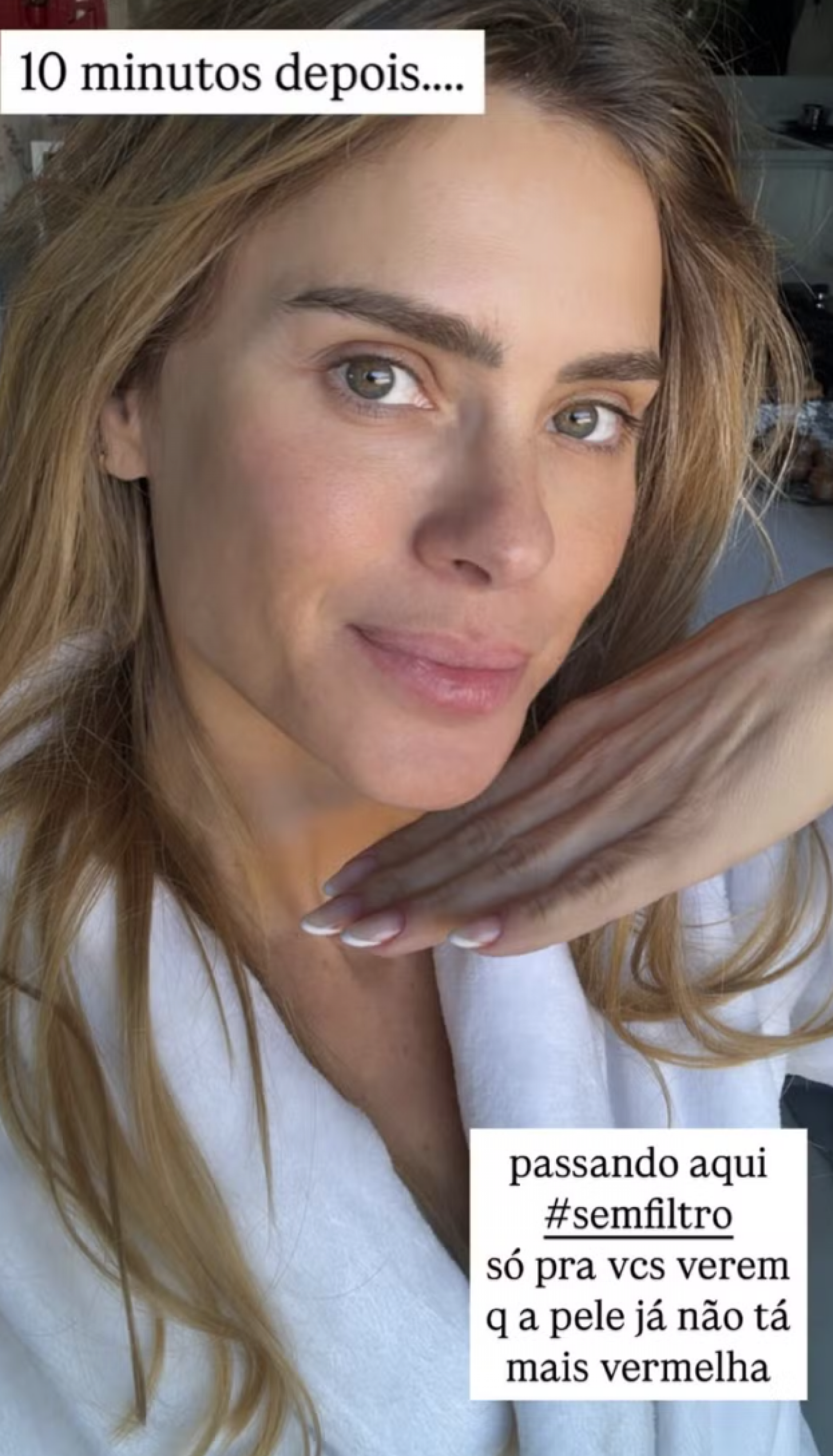 Carolina Dieckmann exibe pele sem filtro após dica de skincare  - reprodução Instagram