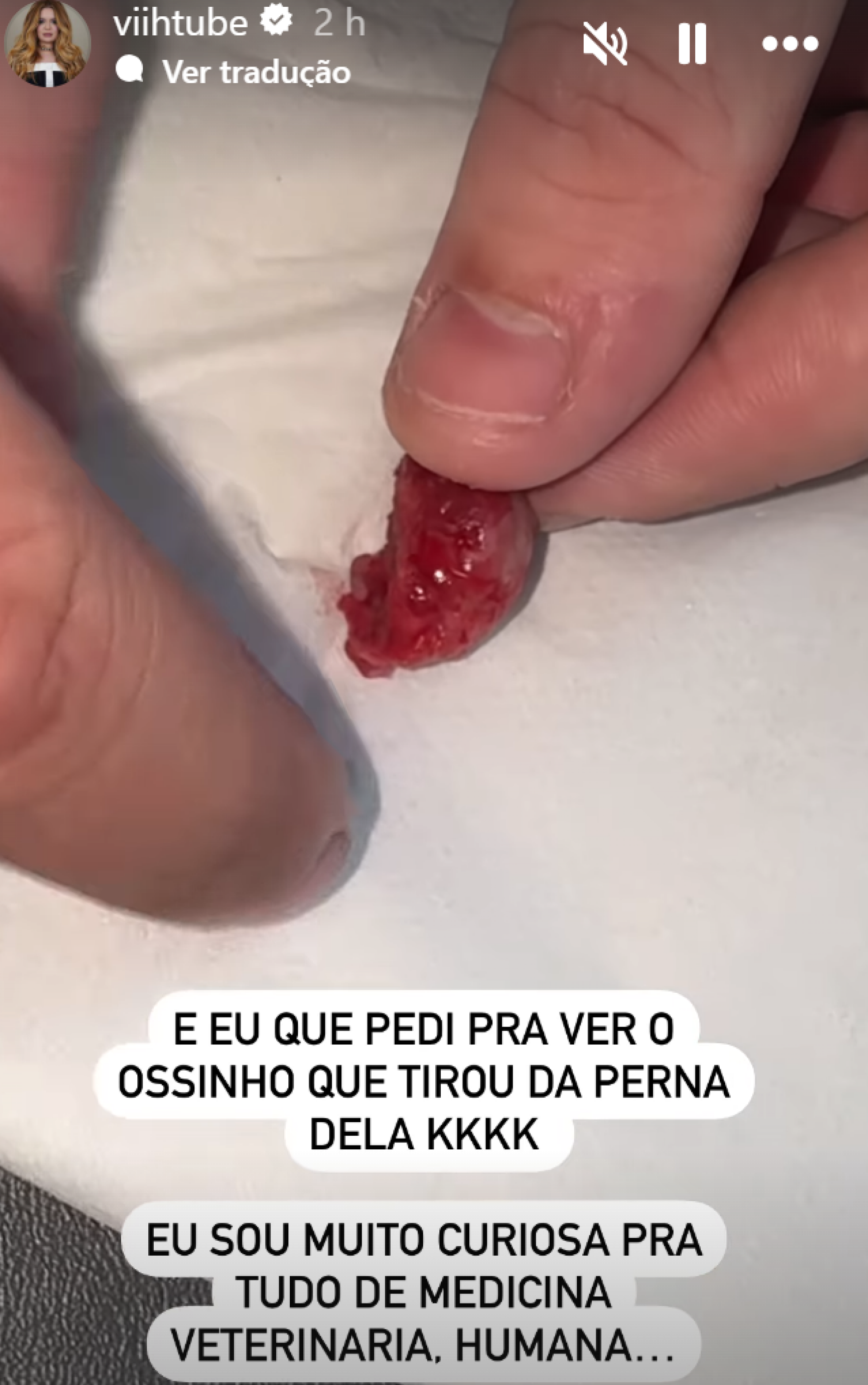 Viih Tube acompanhou operação de Lilo e revelou interesse por procedimentos médicos  - reprodução Instagram