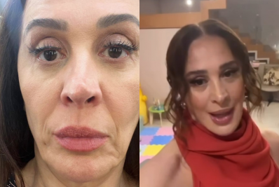 Claudia Raia realiza procedimento estético e exibe resultado