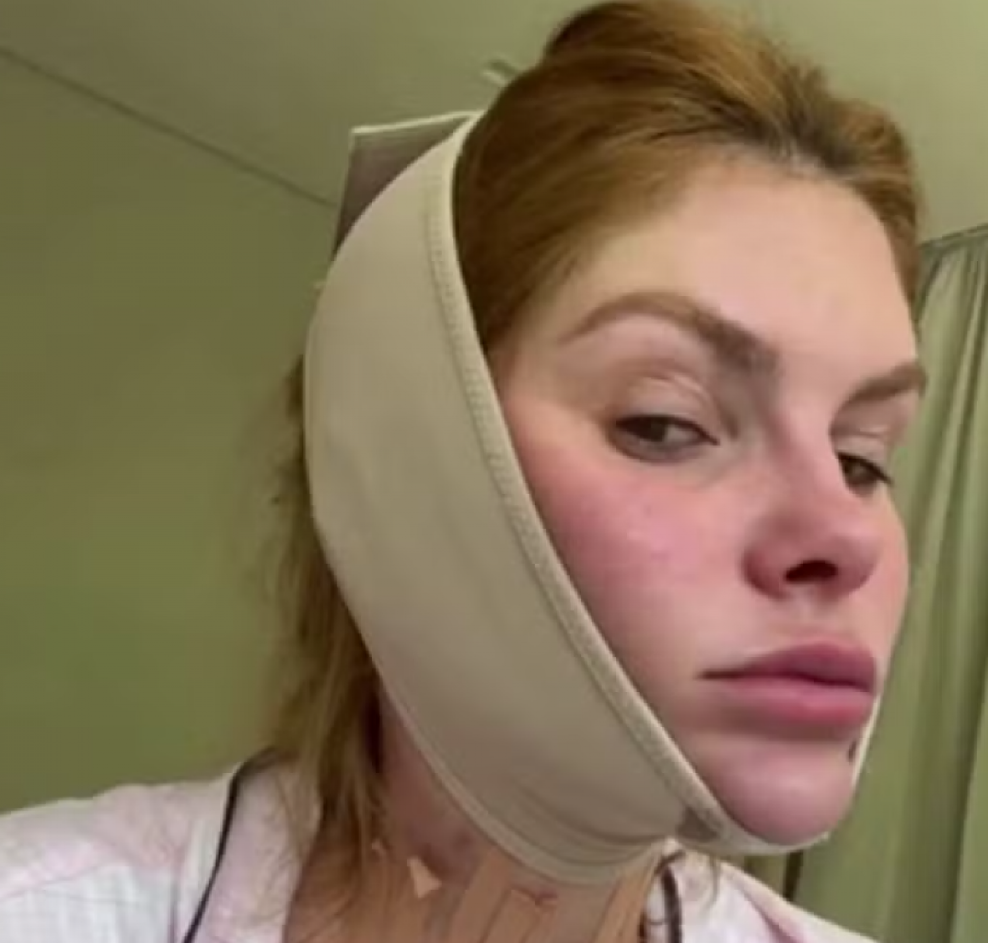 Bárbara Evans usa faixa para reduzir papada e viraliza - reprodução Instagram