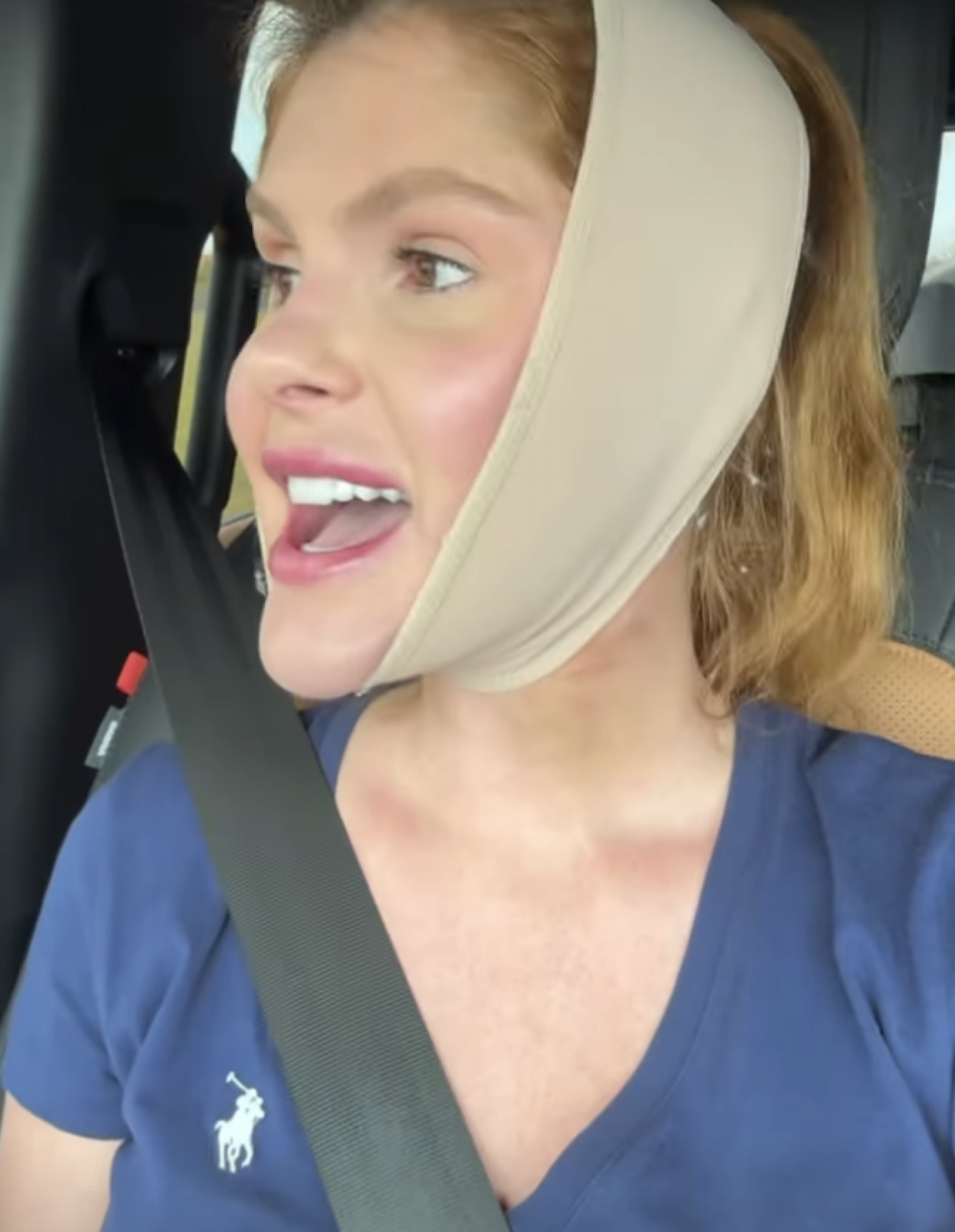 Bárbara Evans usa faixa para reduzir papada e viraliza - reprodução Instagram