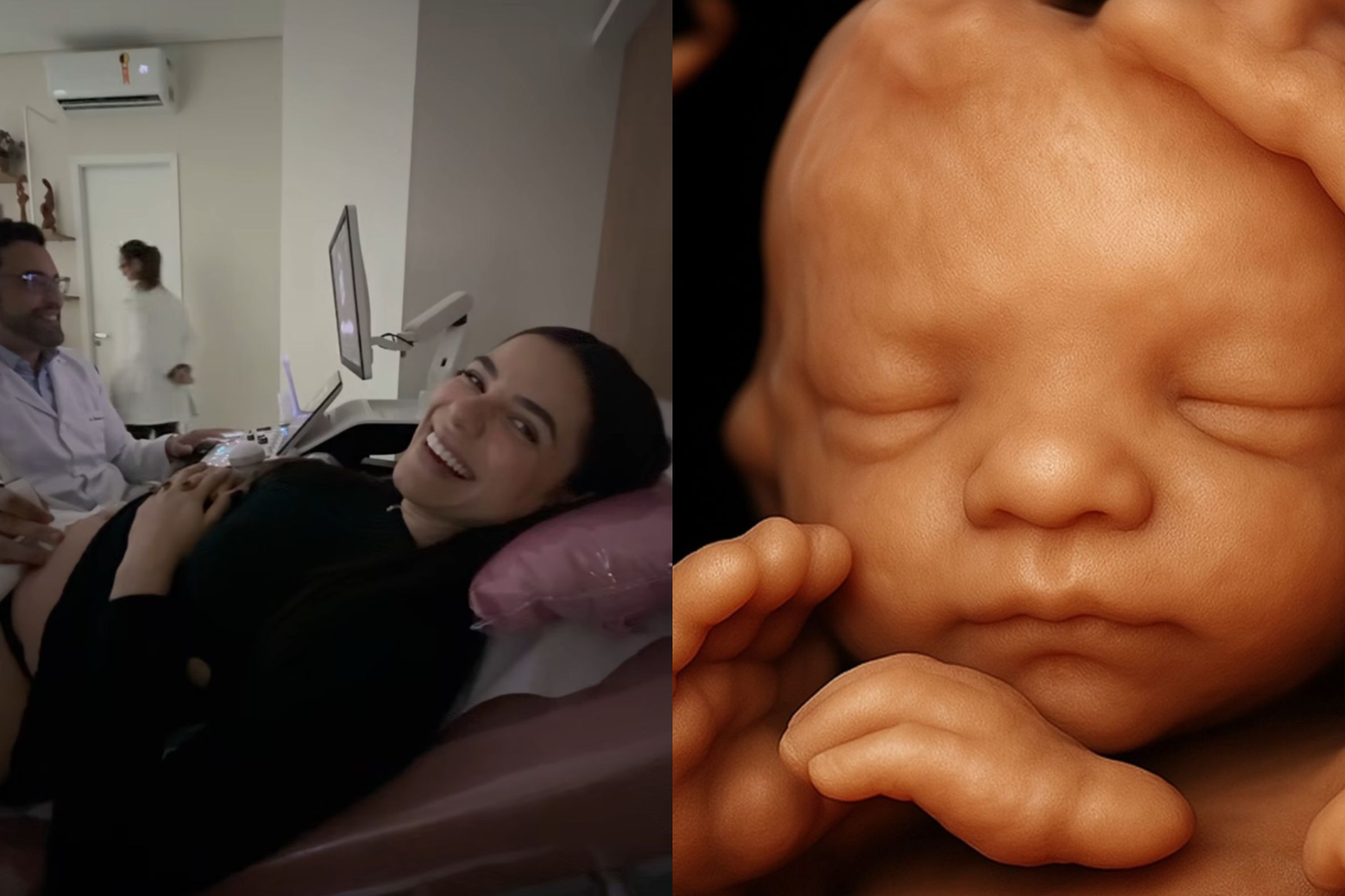 Key Alves mostra ultrassom do primeiro filho - Reprodução Instagram