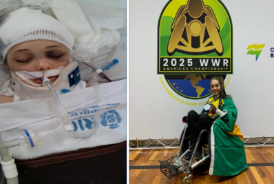 Medicamento experimental pode restaurar movimentos de humanos que tiveram lesão na medula