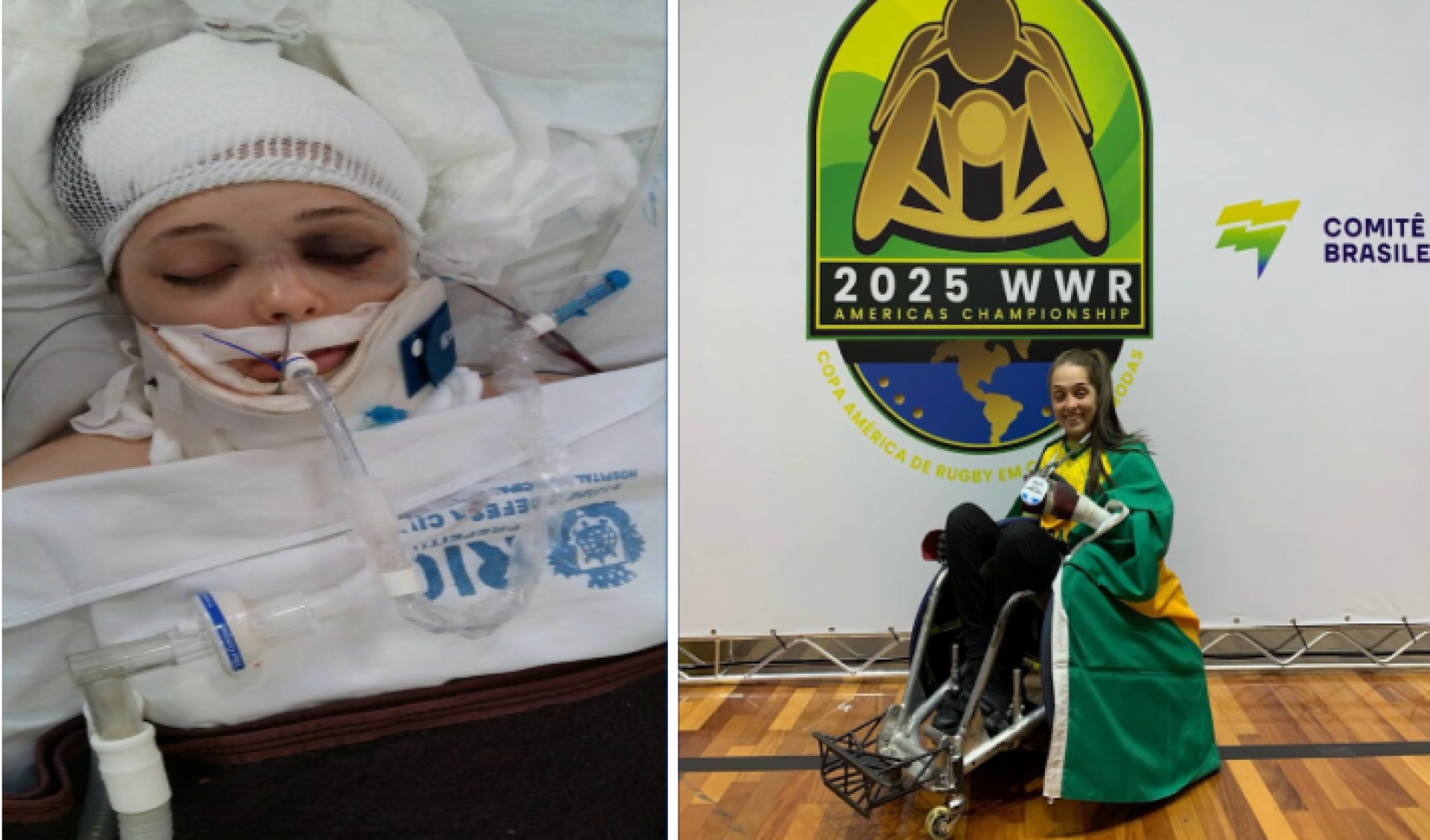 A atleta paral&iacute;mpica de rugby Hawanna Cruz Ribeiro recuperou 70% do controle do tronco ap&oacute;s uso do medicamento - Divulga&ccedil;&atilde;o / Laborat&oacute;rio Crist&aacute;lia