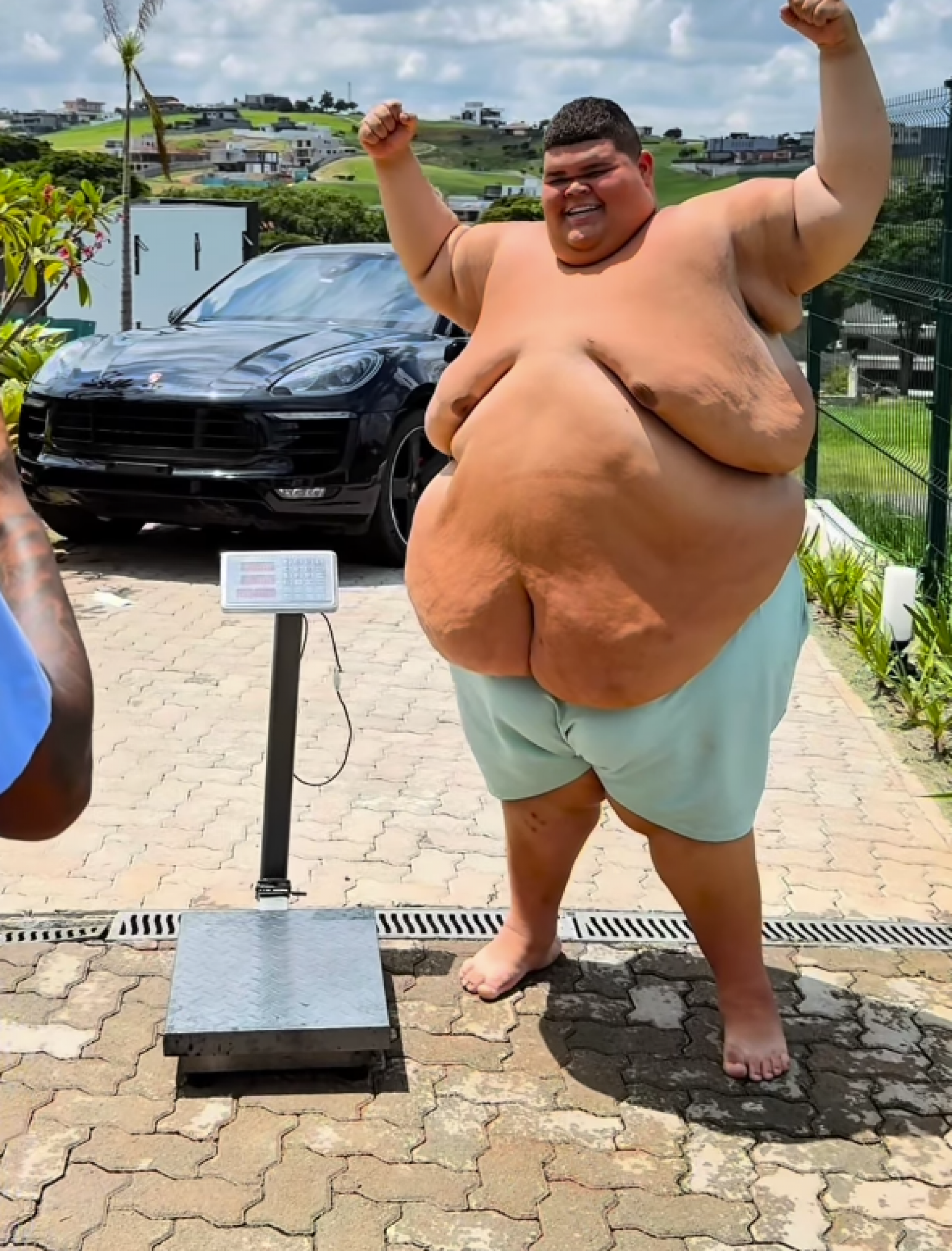 Gordão da XJ perde mais de 115 kg - reprodução Instagram