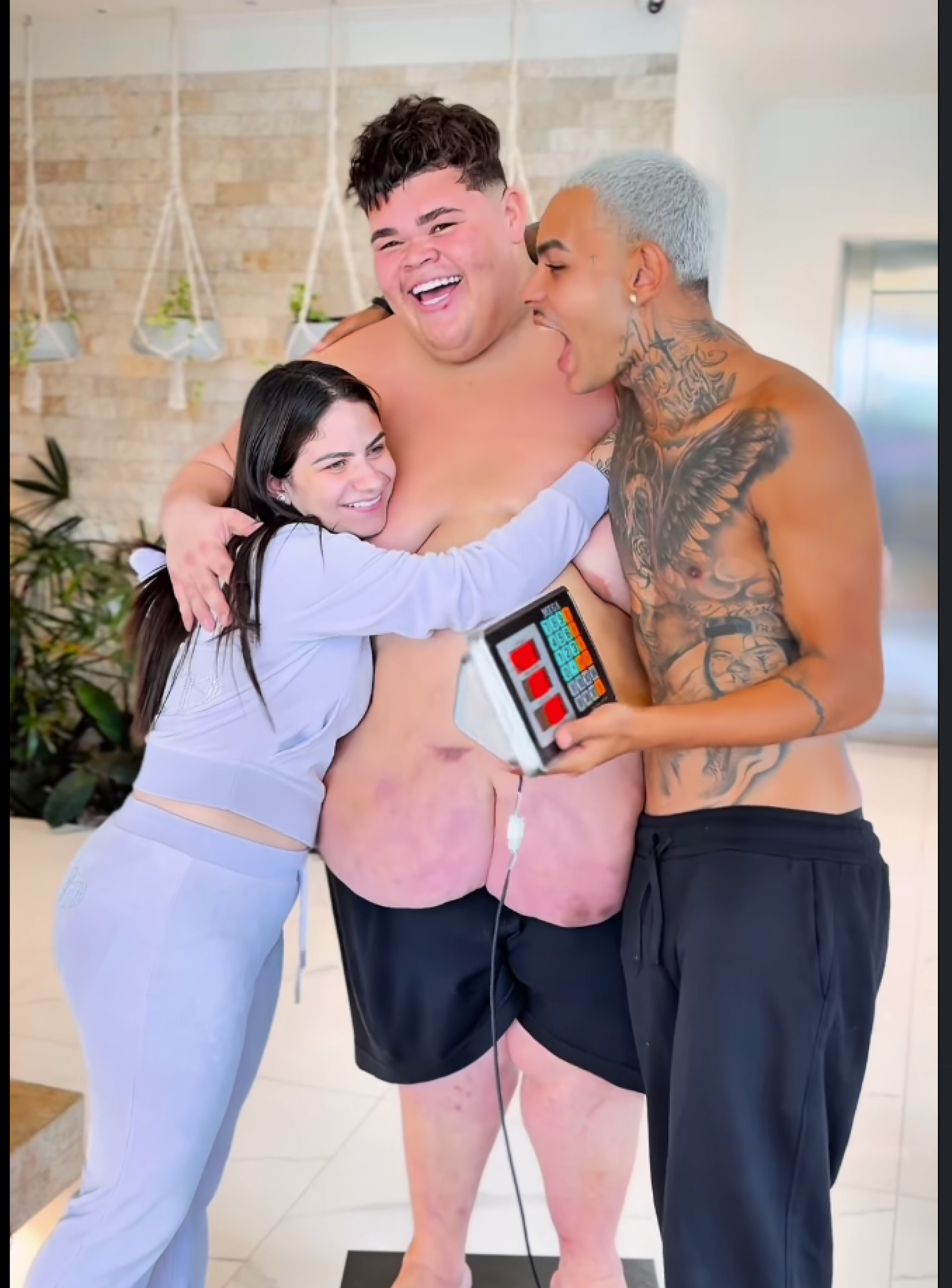 Influenciador Gordão da XJ perde mais de 115 kg e se prepara para cirurgia bariátrica - reprodução Instagram