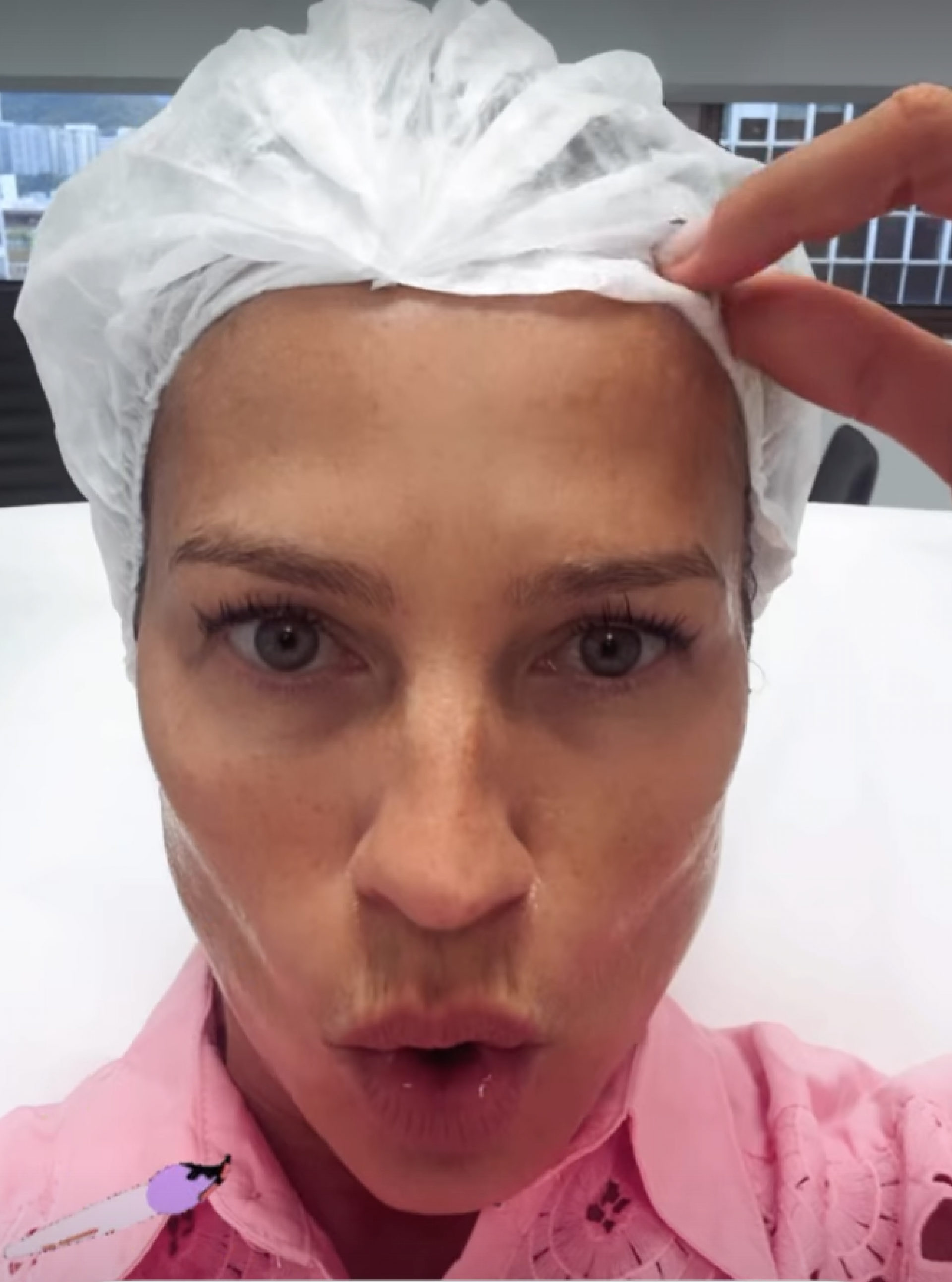 Luana Piovani faz preenchimento facial durante visita ao Brasil - reprodução Instagram