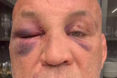 Wanderlei Silva relata consequências por soco do filho de Popó: 'Memória voltando'