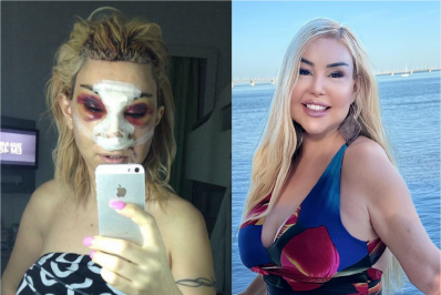 Silicone industrial no rosto coloca Patrícia Ribeiro novamente em estado grave