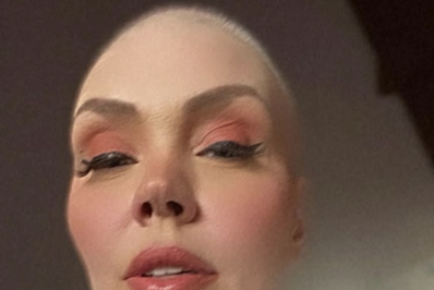 Simony relembra tratamento contra o câncer 