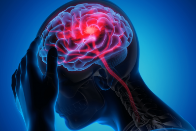 Dia Mundial de Prevenção do AVC: o alerta que pode salvar vidas