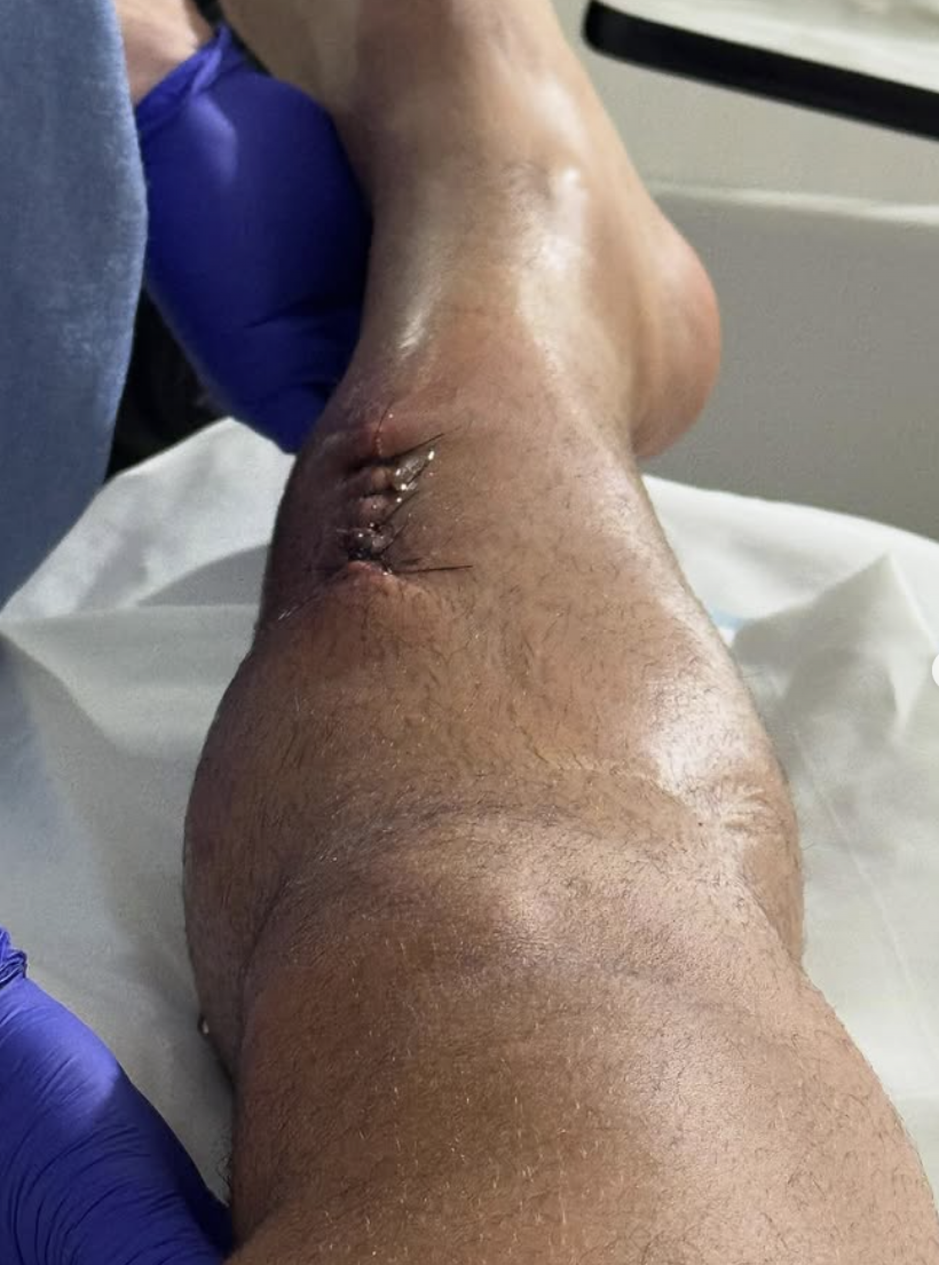 Vittor Fernando fala sobre ataque a tiros e recuperação  - reprodução Instagram