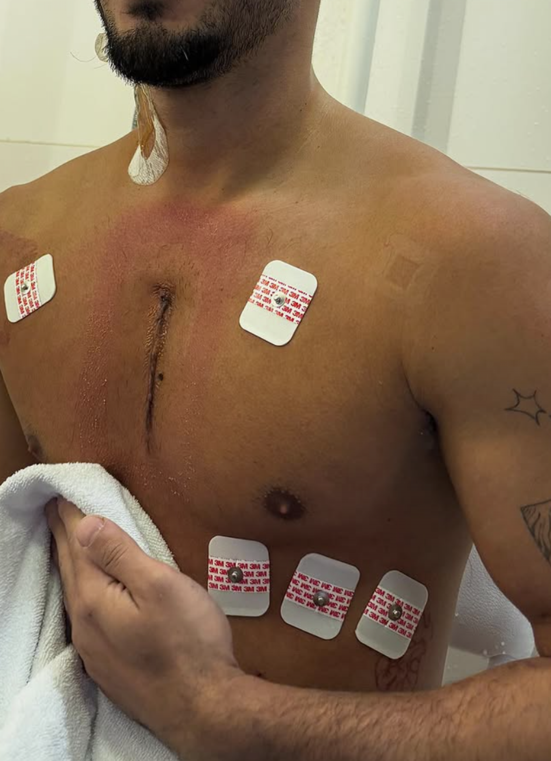 Vittor Fernando fala sobre ataque a tiros - reprodução Instagram