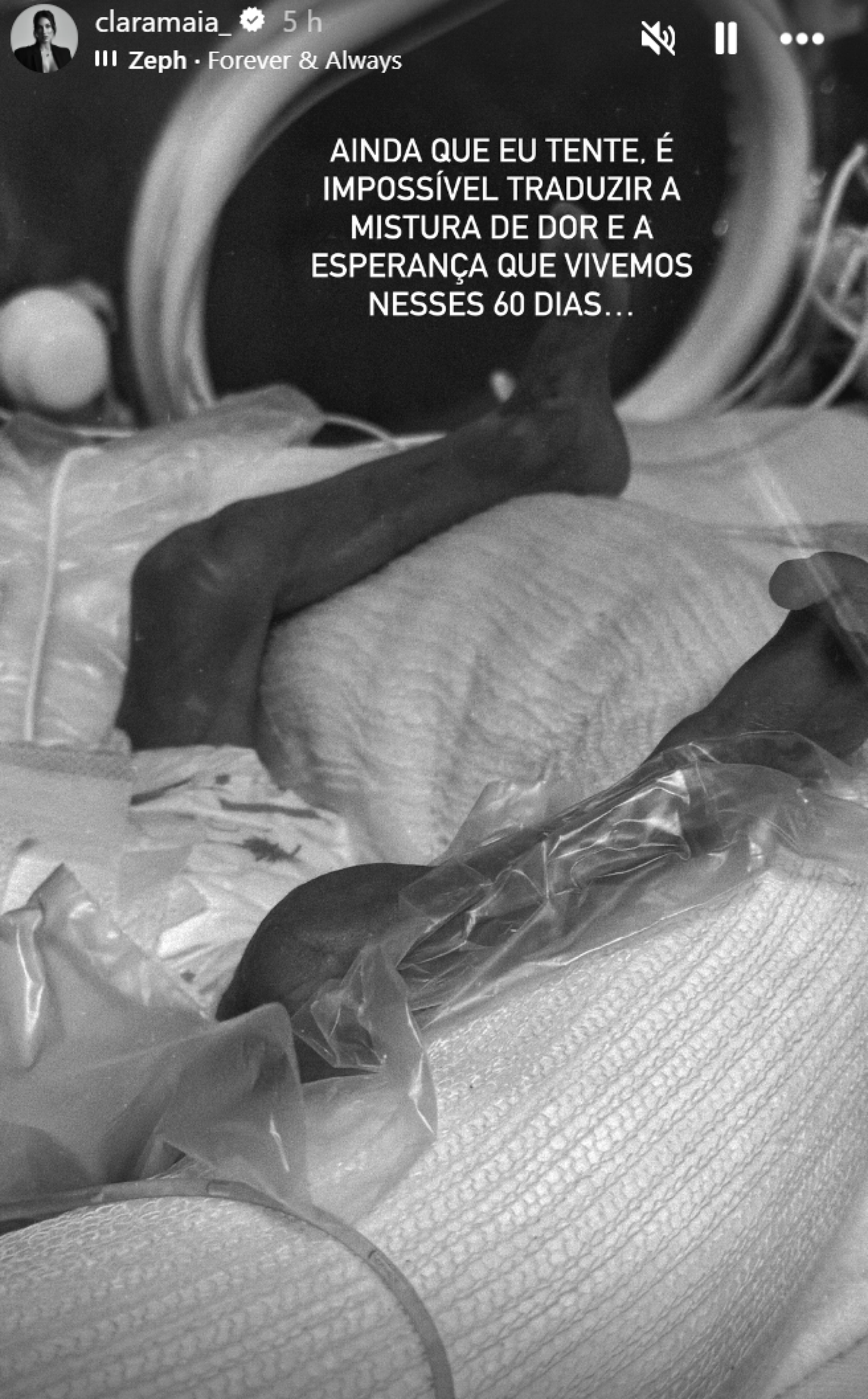 Clara Maia abre o coração ao relembrar parto prematuro e evolução de Theo - reprodução Instagram