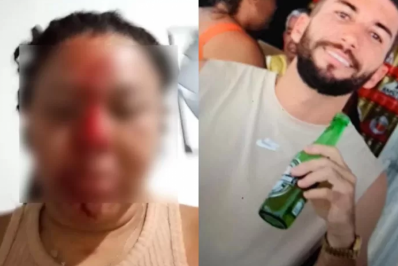 Mulher é agredida pelo ex-companheiro em Araruama