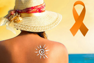 Verão Laranja: câncer de pele e o mito do bronzeado saudável
