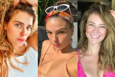 Verão 2026: ‘Aparência natural’ é a aposta da temporada para tratamentos estéticos