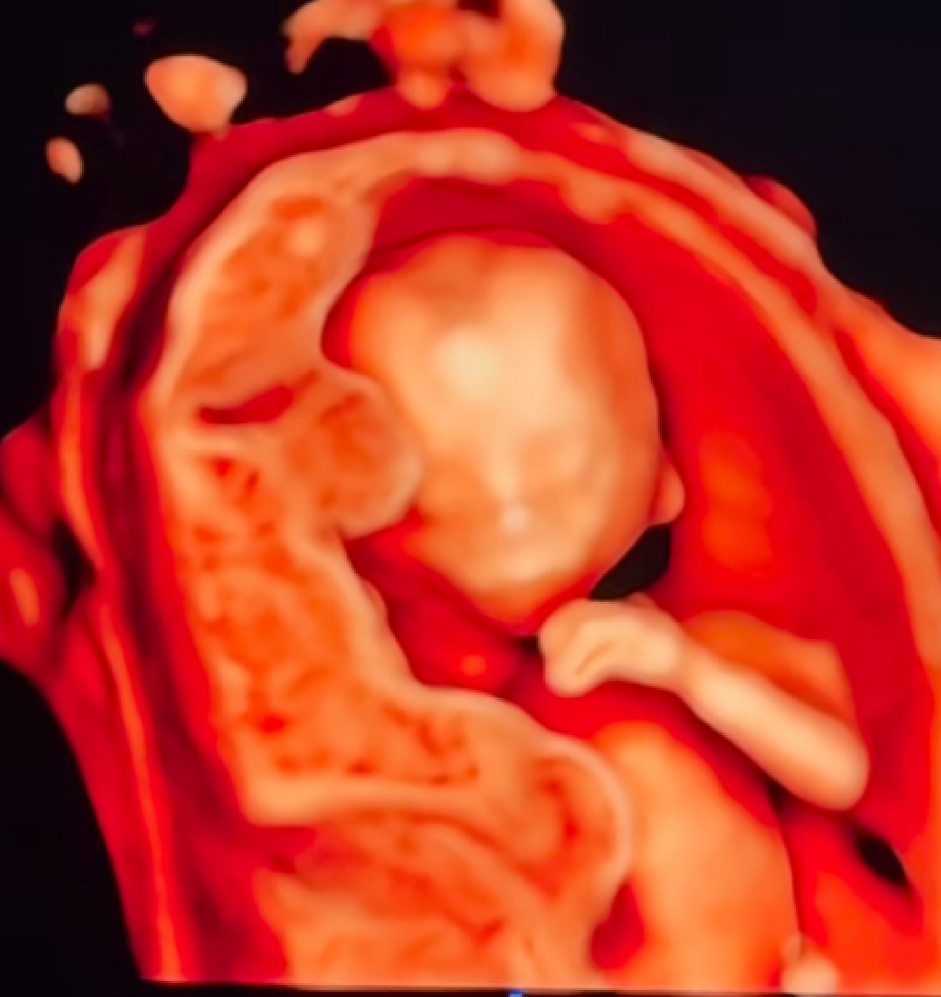 Julio Rocha se emociona ao ver ultrassom do quarto filho e brinca com semelhança: \'Parece uma selfie\'