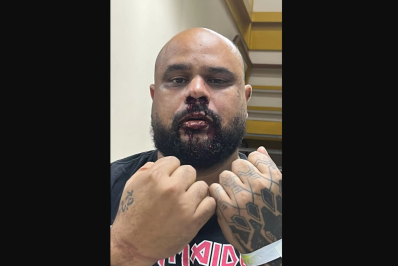 Denúncia de agressão contra homem autista dentro de UPA em Iguaba Grande