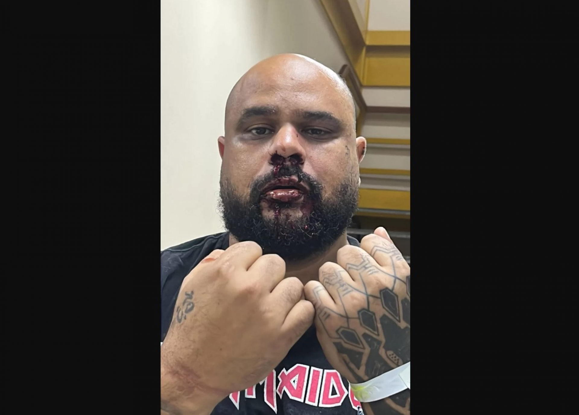 Denúncia de agressão contra homem autista dentro de UPA em Iguaba Grande