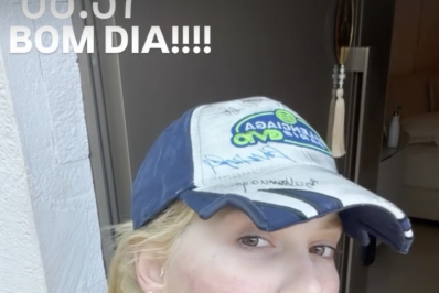 Virginia aparece com rosto marcado após laser para tratar acne