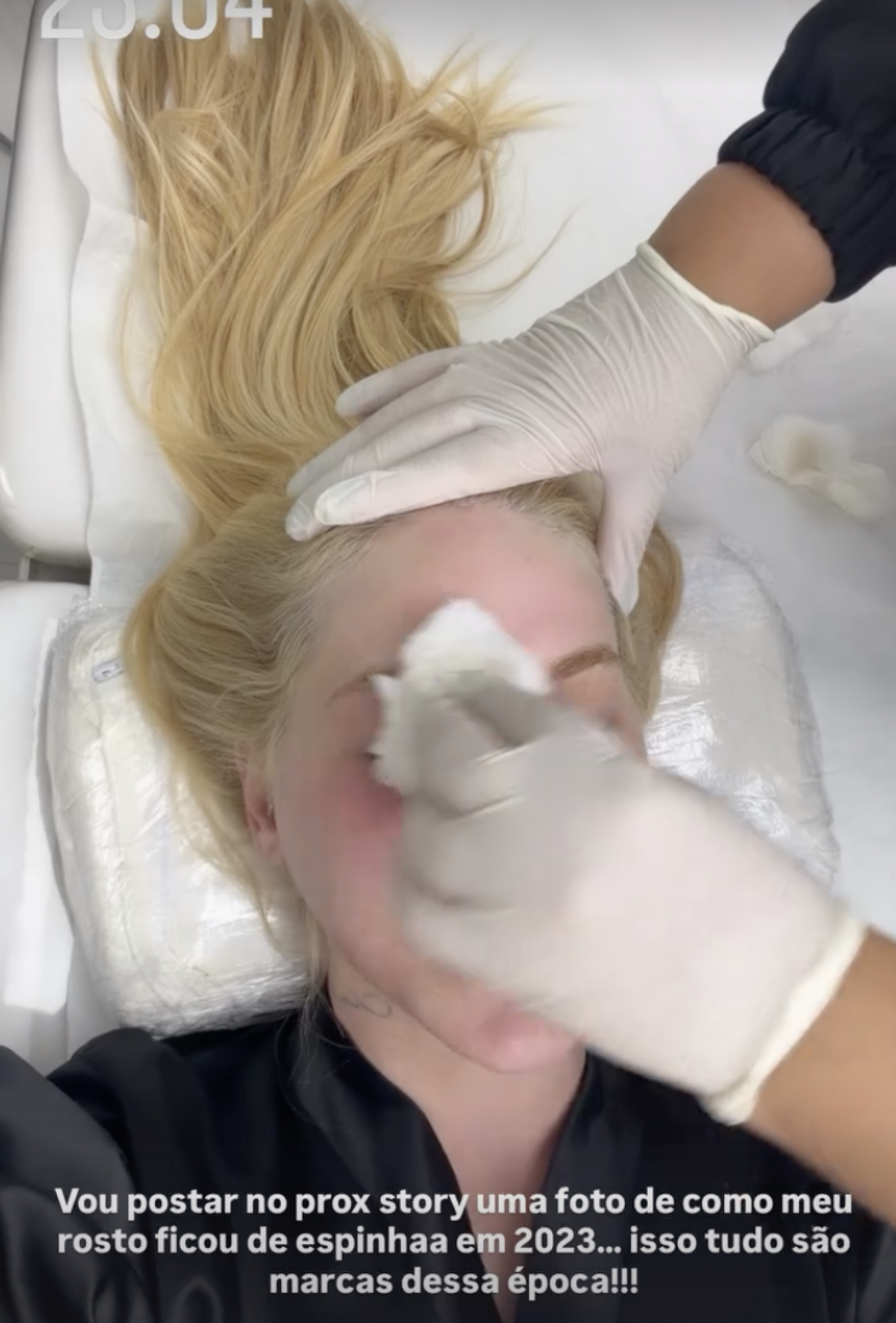 Virgínia mostra resultado de procedimentos - Reprodução/Instagram