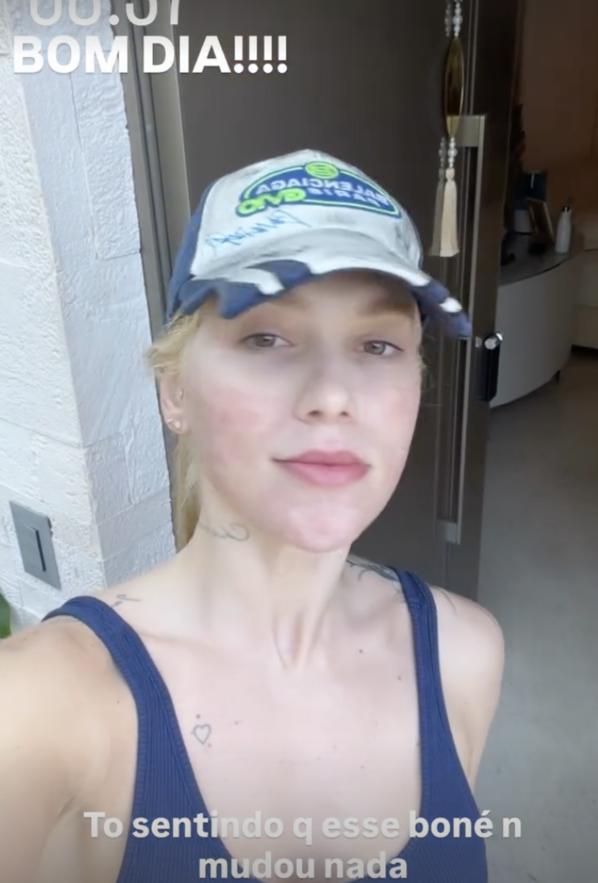 Virgínia mostra resultado de procedimentos - Reprodução/Instagram