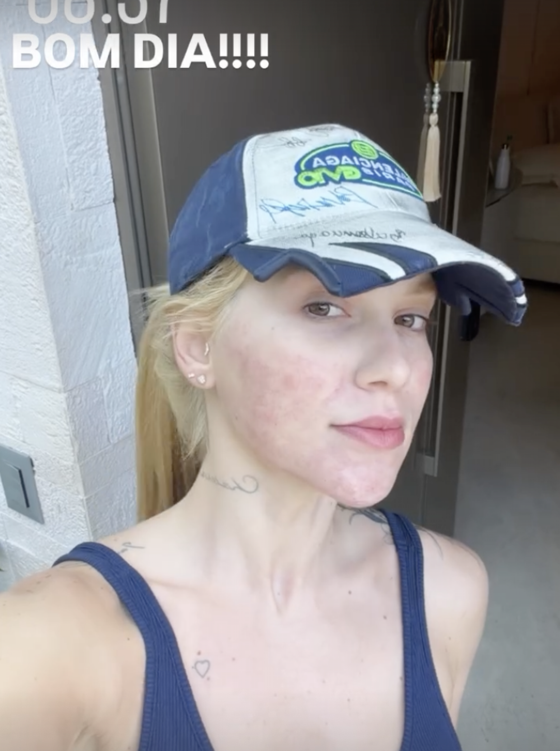 Virgínia mostra resultado de procedimentos - Reprodução/Instagram