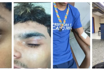 Mãe denuncia agressão contra adolescente autista em escola de Cabo Frio
